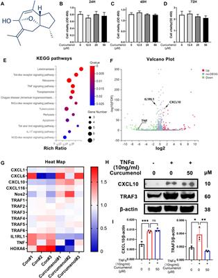 Curcumenol Mitigates the Inflammation and Ameliorates the Catabolism Status of the Intervertebral Discs In Vivo and In Vitro via Inhibiting the TNFα/NFκB Pathway